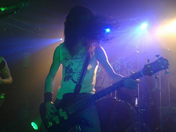 skelethal